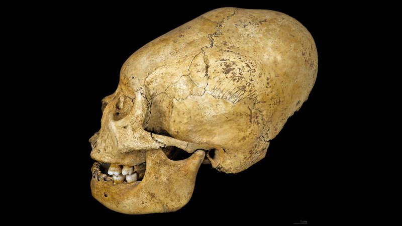 Древните жители на Патагония деформирали черепите си което им е