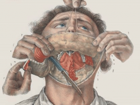 Отстраняване на долната челюст. Richard Barnett / The Wellcome Trust