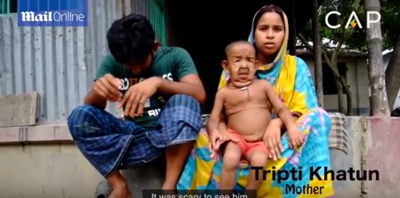 4-годишно дете в Бангладеш, засегнато от мистериозно заболяване, заради което