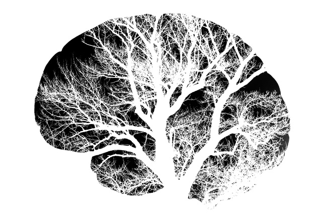 Човешкият мозък е толкова мощен че интелигентните  компютри наречени невронни