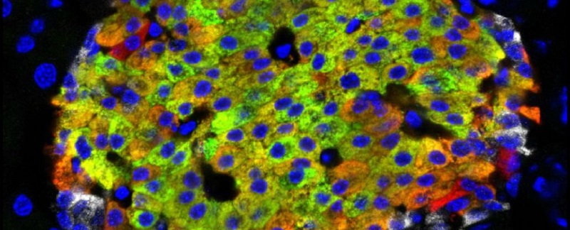 Съвсем нов тип произвеждащи инсулин клетки бяха открити в панкреаса